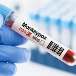 Kemenkes: Waspada Penularan Cacar Monyet dari Manusia ke Hewan